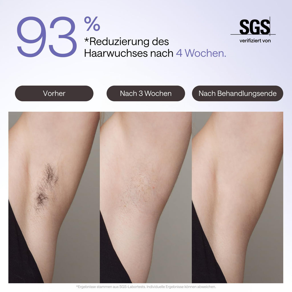 IPL Haarentfernungsgerät Air 3 Deluxe für Gesicht und Körper mit Saphir-Kühlung UV-Sterilisator und Aloe Vera Gel