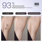 IPL Haarentfernungsgerät Air 3 Deluxe für Gesicht und Körper mit Saphir-Kühlung UV-Sterilisator und Aloe Vera Gel