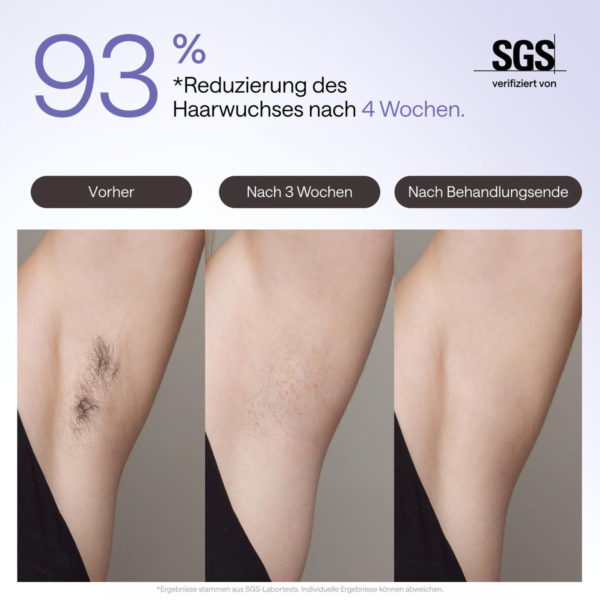 IPL Haarentfernungsgerät Air 3 Deluxe für Gesicht und Körper mit Saphir-Kühlung UV-Sterilisator und Aloe Vera Gel
